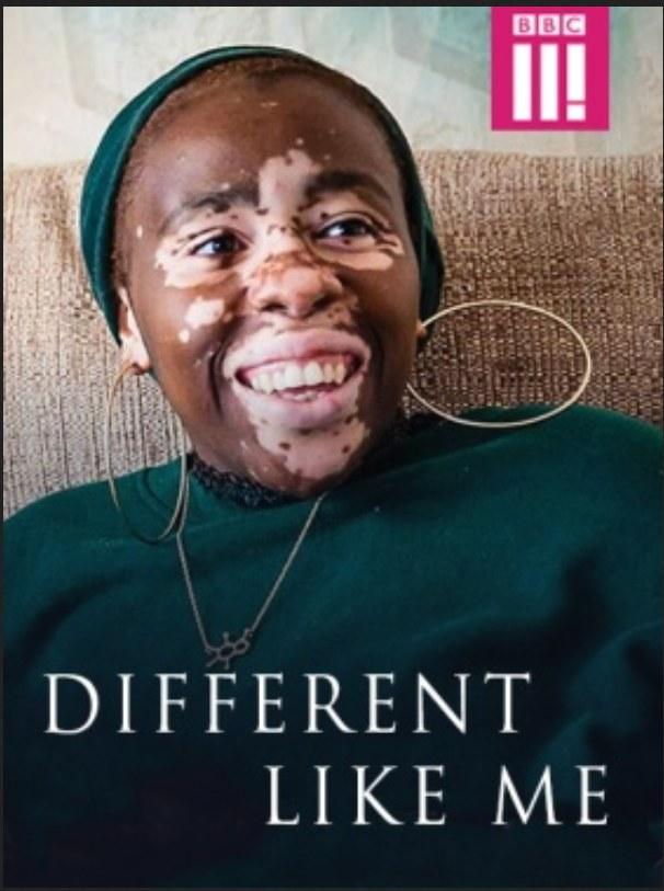 һ.Different.Like Me.1080P.Ƕ (2018)