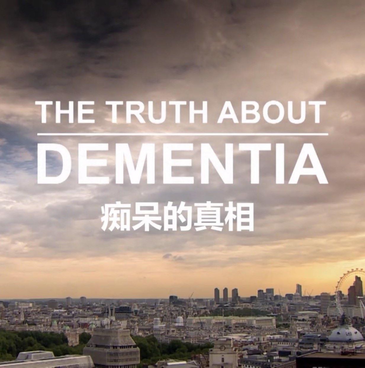 մ.Ӣ.1080P.The.Truth.About.Dementia (2016)